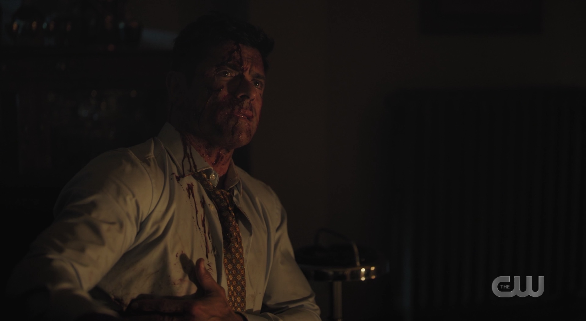 A bloodied Hiram Lodge