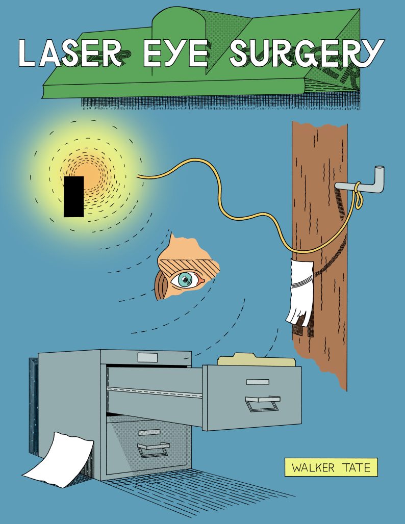 Laser Eye Surgery